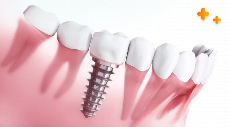 Single Tooth Implant Cost Without Insurance